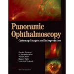 Panoramic Ophthalmoscopy, Optomap Images and Interpretation