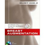 Breast Augmentation (McGraw-Hill Plastic Surgery Atlas)