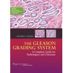Gleason Grading System: A Complete Guide for Pathologist and Clinicians