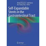 Self-Expandable Stents in the Gastrointestinal Tract