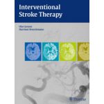 Interventional Stroke Therapy