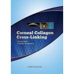 Corneal Collagen Cross Linking