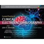 Current Practice of Clinical Electro encephalography