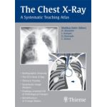 Chest X-Ray: A Systematic Teaching Atlas