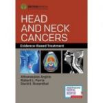 Head and Neck Cancers: Evidence-Based Treatment