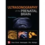 Ultrasonography of the Prenatal Brain