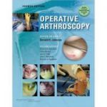 Operative Arthroscopy