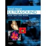 Fetal Heart Ultrasound: How, Why and When