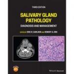 Salivary Gland Pathology: Diagnosis and Management
