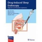 Drug-Induced Sleep Endoscopy: Diagnostic and Therapeutic Applications