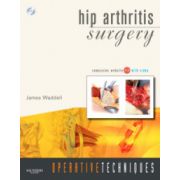 Operative Techniques: Hip Arthritis Surgery