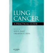 Lung Cancer: A Practical Guide