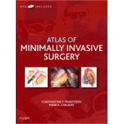 Atlas of Minimally Invasive Surgery (with DVD)