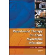 Reperfusion Therapy for Acute Myocardial Infarction