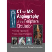 CT and MR Angiography of the Peripheral Circulation: Practical Approach with Clinical Protocols