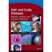 Hair and Scalp Diseases: Medical, Surgical, and Cosmetic Treatments