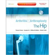 Arthritis and Arthroplasty: Hip
