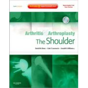 Arthritis and Arthroplasty: Shoulder