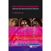 Basic Electrocardiography: Normal and Abnormal ECG Patterns