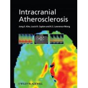 Intracranial Atherosclerosis