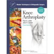 Master Techniques in Orthopaedic Surgery: Knee Arthroplasty