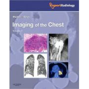 Imaging of the Chest, 2-Volume Set (Expert Radiology Series)