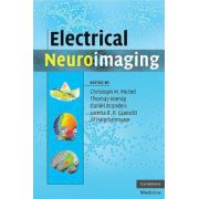 Electrical Neuroimaging