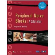 Peripheral Nerve Blocks