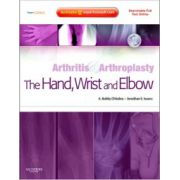 Arthritis and Arthroplasty: Hand, Wrist and Elbow