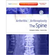 Arthritis and Arthroplasty: Spine