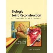 Biologic Joint Reconstruction: Alternatives to Joint Arthroplasty