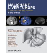 Malignant Liver Tumors: Current and Emerging Therapies