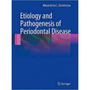 Etiology and Pathogenesis of Periodontal Disease