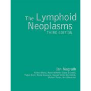 Lymphoid Neoplasms