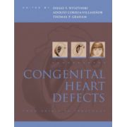 Congenital Heart Defects: From Origin to Treatment