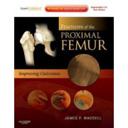Fractures of the Proximal Femur: Improving Outcomes