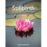 Stillbirth: Prediction, Prevention and Management