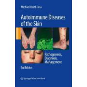 Autoimmune Diseases of the Skin: Pathogenesis, Diagnosis, Management