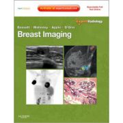 Breast Imaging (Expert Radiology Series)