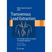 Transvenous Lead Extraction: From Simple Traction to Internal Transjugular Approach