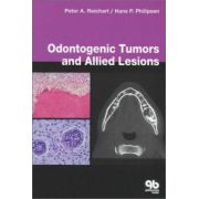 Odontogenic Tumors and Allied Lesions