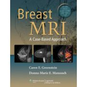 Breast MRI: A Case-Based Approach