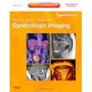 Gynecologic Imaging (Expert Radiology Series)