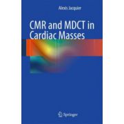CMR and MDCT in Cardiac Masses