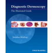 Diagnostic Dermoscopy: Illustrated Guide