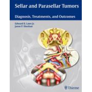 Sellar and Parasellar Tumors: Diagnosis, Treatments, and Outcomes