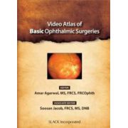 Video Atlas of Basic Ophthalmic Surgeries