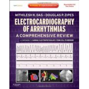 Electrocardiography of Arrhythmias, A Comprehensive Review: A Companion to Cardiac Electrophysiology