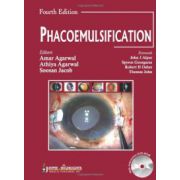 Phacoemulisification