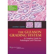 Gleason Grading System: A Complete Guide for Pathologist and Clinicians